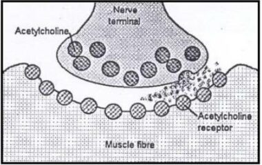 Diagram of a normal neuromuscular junction