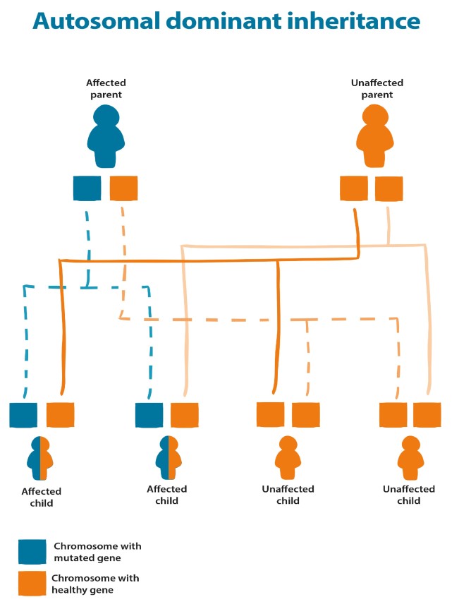 This diagram shows what would happen if an affected parent with an automsomal dominant condition and an unaffected parent had children. Two of the four children would be affected and the other 2 would be unaffected. 