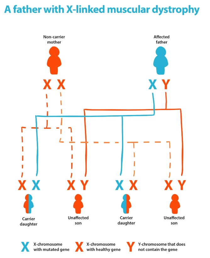 This diagram shows the likely outcome if a non-carrier mother and an affected father had children. They have 4 children; two carrier daughters and two unaffected sons.