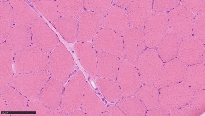 This image shows healthy adult muscle taken from a biopsy. It is made up of closely packed fibres which are all a similar size.